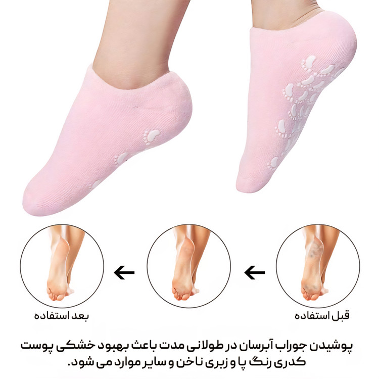 جوراب رفع ترک پا